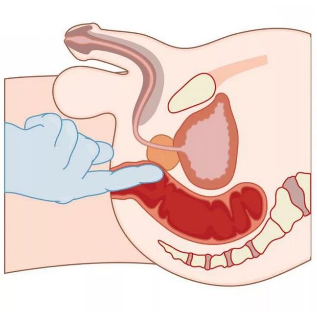 Umístění mužského bodu G